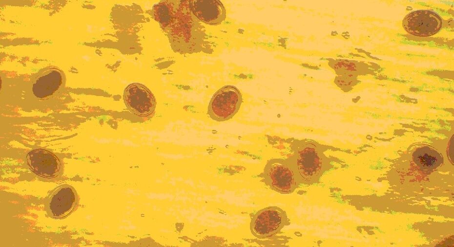 huevos de gusano bajo un microscopio