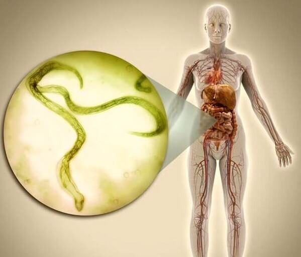 Parásitos en el cuerpo humano