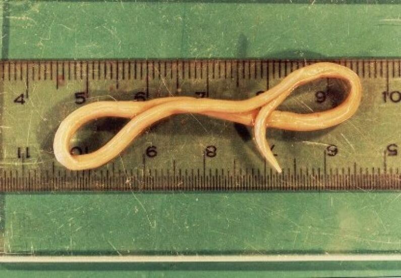 parásito lombriz intestinal del cuerpo humano
