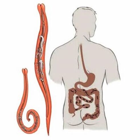 gusanos en los intestinos humanos