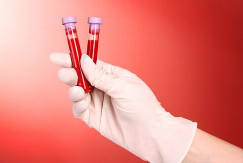 análisis de sangre para parásitos