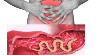 síntomas de la presencia de parásitos en el intestino humano